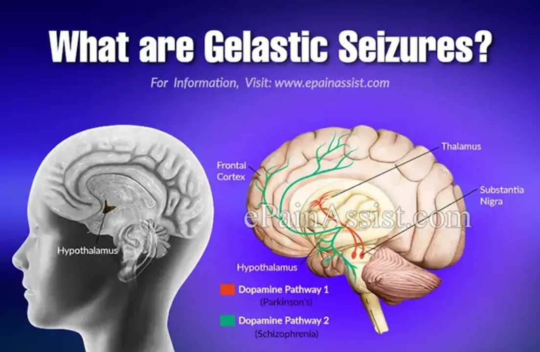 Exercise and seizures: Can physical activity help reduce seizure frequency?